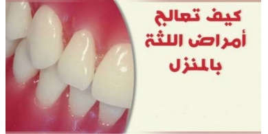 كيف تعالج أمراض اللثة بالمنزل ؟
