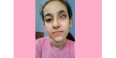 الطفلة اناغيم للرئيس: عيني بحاجة للعلاج