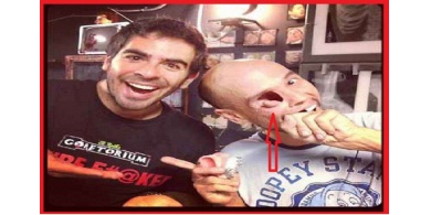 لن تصدقوا كيف خسر هذا الرجل عينه!
