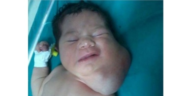 شاهد : طبيب فلسطيني يعيد وجه طفلة إلى صورته الملائكية من جديد !