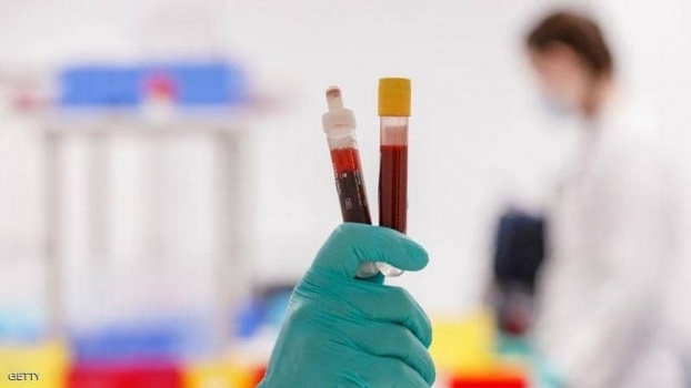 لماذا يعجز بعض المتعافين من كوفيد عن إنتاج أجسام مضادة؟