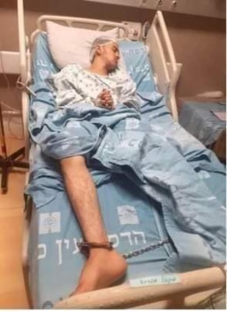 الأسير الفتى محمد مقبل يخضع لعملية جراحية بعد اعتداء جنود الاحتلال عليه