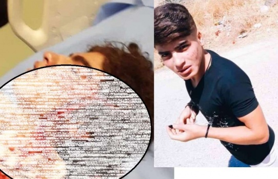 "بهاء" حدث يقع ضحية اعتداء جديد بأداة حادة في الأردن