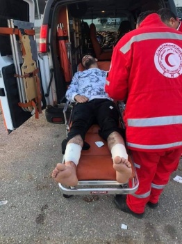 إصابة عامل من بلدة عرابة برصاص الاحتلال جنوب جنين