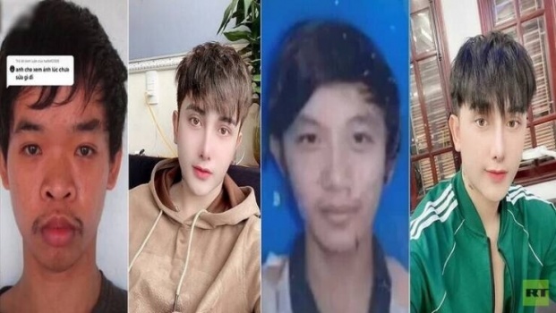 صور| شاب فيتنامي يجري 9 عمليات تجميل بعد السخرية من شكله خلال مقابلة عمل!