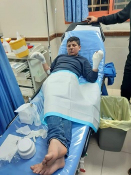 إصابة طفل إثر انفجار قنبلة من مخلفات الاحتلال في طوباس
