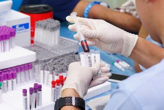 روسيا تبدأ إنتاج لقاح ثالث مضاد لفيروس كورونا