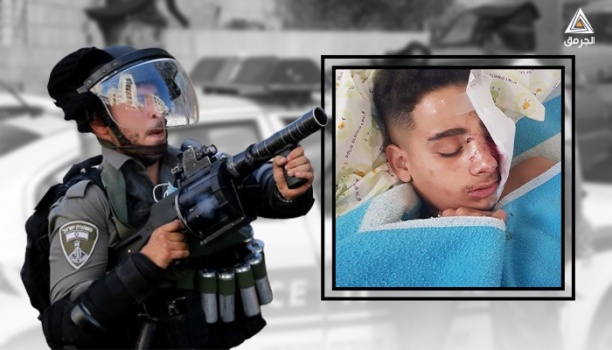 باسل أبو العلا.. طفلٌ فلسطيني قلعت الشرطة “الإسرائيلية” عينه