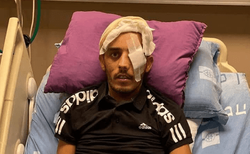 فقد عينه في الأقصى واعتقل - الاحتلال يحول جريحا للحبس المنزلي