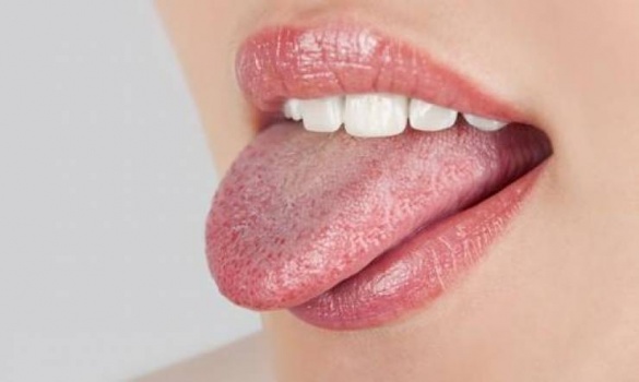 6 طرق طبيعية تخلّصك من حروق اللسان