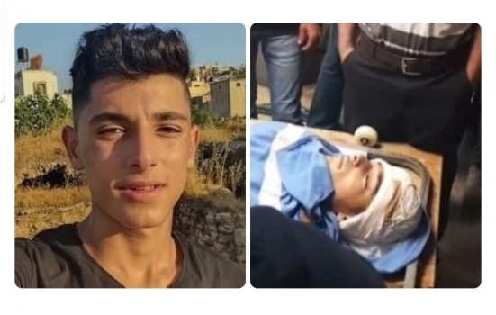 استشهاد فتى من بيتا متأثراً بجراحه