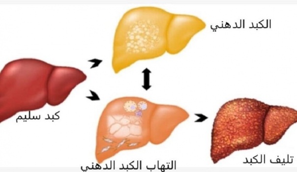  7 أطعمة مجربة تجدد أنسجة الكبد وتطهره من السموم 