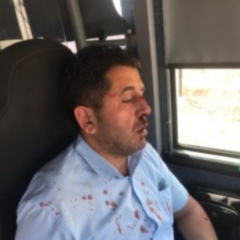 إصابة سائق حافلة مقدسي بجروح إثر اعتداء مستوطن عليه