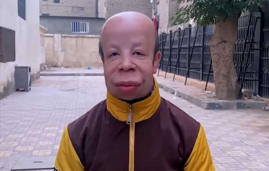 حسام بوجي ضحية التنمر في مصر يحصد ملايين المشاهدات