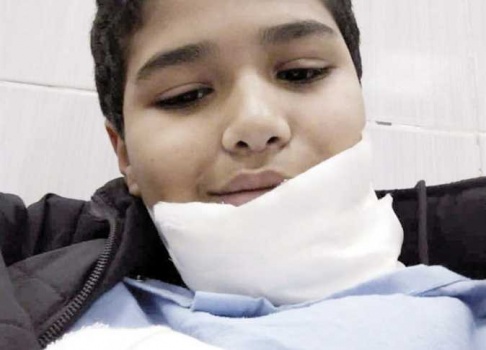 تلميذ ابتدائي يمزق وجه زميله بسلاح أبيض