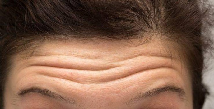  أسباب تجاعيد الجبين وكيفية التخلص منها