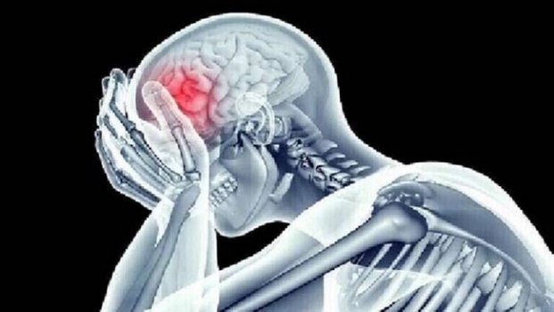 أنواع الصداع التي تشير إلى قرب الإصابة بالجلطة الدماغية
