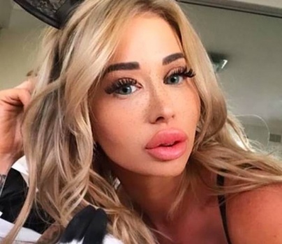 تنفق 100 ألف دولار بسبب إدمانها على عمليات التجميل