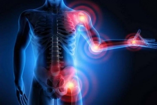تعديل النظام الغذائي تأثيره ضئيل أو معدوم في تطور التهاب المفاصل