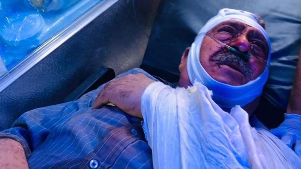 إصابة 6 مواطنين باعتداء للمستوطنين شمال رام الله