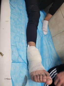 إصابة طفل برصاص الاحتلال في مخيم عايدة