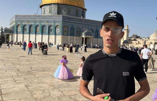 استشهاد شاب مقدسي متأثرا باصابته برصاص الاحتلال قبل نحو عامين