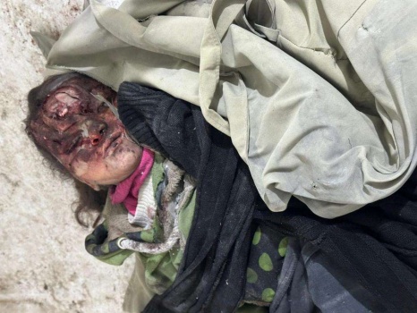 الأورومتوسطي: نحو 25 ألف شهيد في غزة بينهم 10 آلاف طفل