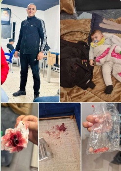 أطلقوا النار عليه وهو نائم.. الاحتلال حاول إعدام شاب عند اعتقاله من مخيم الجلزون