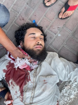 شخص يطعن شرطيًا قبل أن يطعن نفسه بالخليل