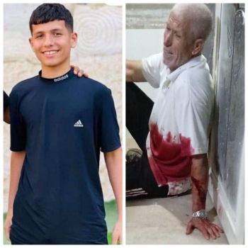 استشهاد طفل وإصابة والده برصاص الاحتلال في مخيم طولكرم