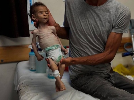 شهداء في قصف للاحتلال على غزة.. وآخرون ارتقوا نتيجة التجويع