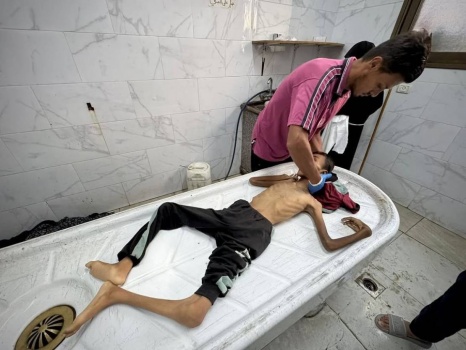 الجوع يقتل 4 بينهم طفلان خلال ساعات بقطاع غزة