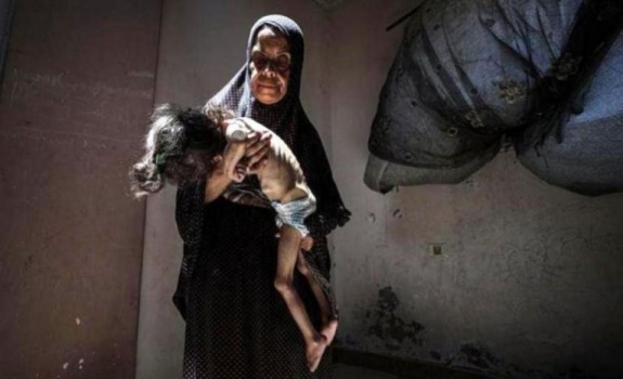 صحة غزة: 66 شهيدًا وحالتي وفاة إثر المجاعة خلال آخر 24 ساعة