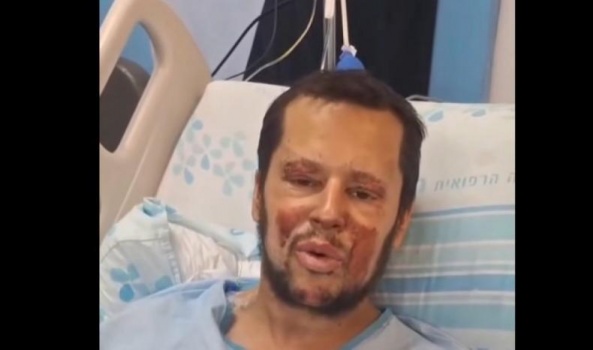 "بعضُ ثأر غزة يُسترد في جنوب لبنان"&hellip; "بوعز تمام" مرتكب جرائم الحرب في جباليا تشوّهه كورنيت حزب الله