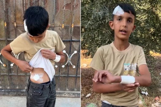 رصاص وضرب حتى الإغماء.. طفل فلسطيني يقع فريسة لوحشية الاحتلال بنابلس
