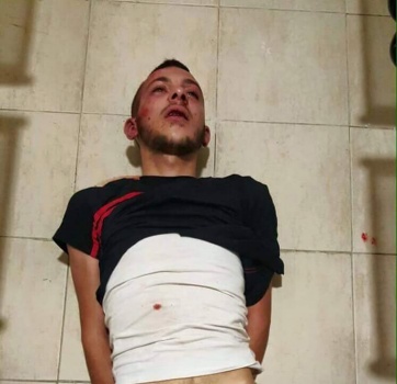 فيديو وصور|جنين: اعتقال شاب من سيلة الحارثية بدعوى طعنه اسرائيليين في الخضيرة
