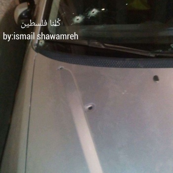 صور : اصابة سيدة برصاص مجهولين