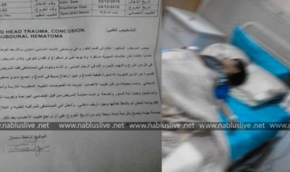 نابلس: اعتداء على طفل يتسبب بصرعه وارتجاج دماغه!!