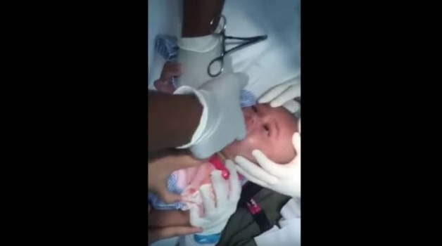 فيديو|الأطباء يستخرجون ساعة من حلق "رضيع" !!
