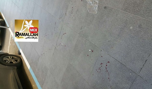 مجهولون يعتدون بالضرب على شاب في رام الله