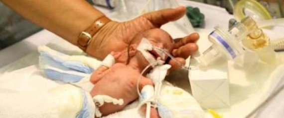 نصف مليون درهم إماراتي فاتورة ولادة في دبي!