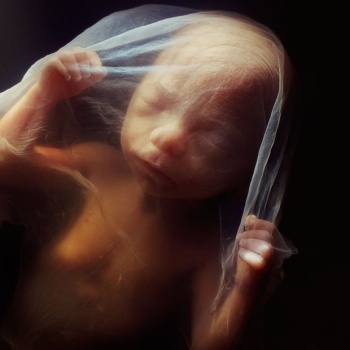 صور حقيقية لـ &ldquo;تطور الجنين&rdquo; داخل رحم الأم