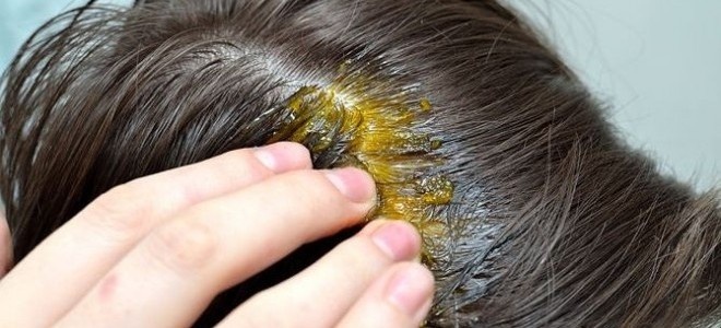 وصفة سحرية لإعادة إنبات الشعر من جديد وملىء الفراغات في إسبوع!