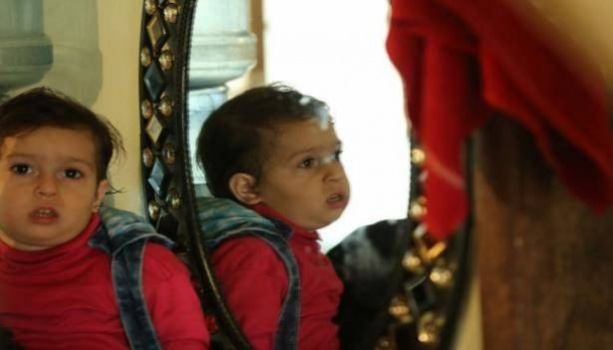 رضيعة بالغة في بيروت.. ليمار حالة نادرة حول العالم