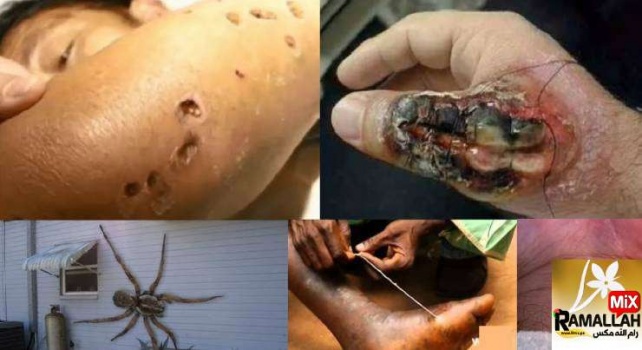 فيديو : أخطر 10 حشرات على وجه الارض!
