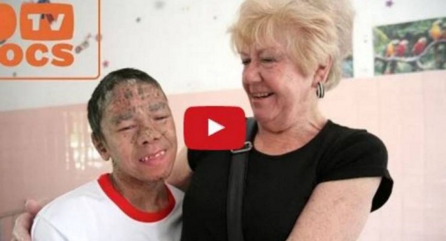 فيديو| سخروا منه ولقبوه بالسمكة.. لكن ما تفعله هذه السيدة له مؤثر جداً؟