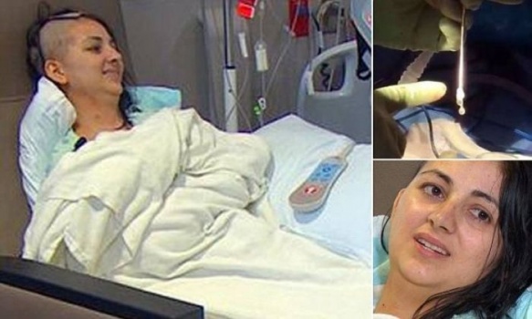عانت من الصداع لمدة تسعة اشهر وعندما توجهت للطبيب اكتشف امرا مرعبا!