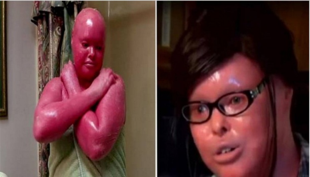 هذه المرأة ولدت مصابة بمرض نادر وحققت 3 معجزات خلال 20 سنة !