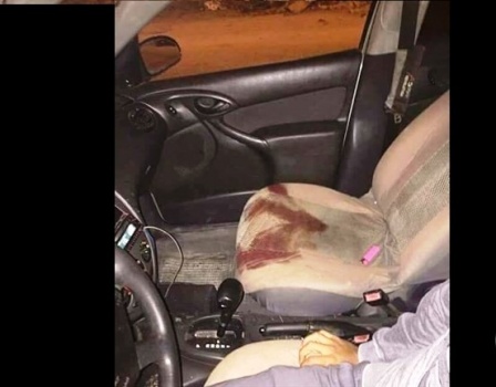 3 إصابات برصاص الأحتلال واعتقال شاب بمخيم نور شمس بطولكرم