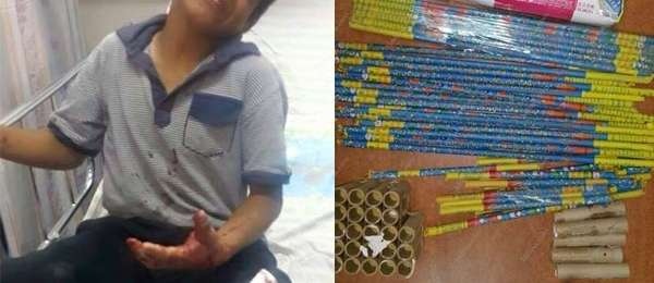 اصابة طفل بسبب الألعاب النارية جنوب جنين